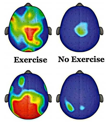 Benefits for kids who play soccer: Graphic showing brain activity from exercise